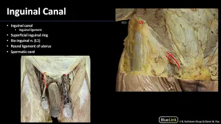 Abdominal Muscles & Inguinal Canal - Dissection Supplement