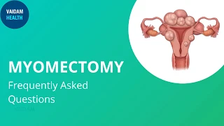 Myomectomy- Frequently Asked Questions