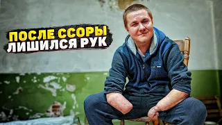 ЛИШИЛСЯ РУК В 16 ЛЕТ, ЛЮБИМАЯ ДЕВУШКА БРОСИЛА НА СЛЕДУЮЩИЙ ДЕНЬ