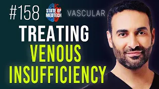 Treating Venous Insufficiency in a New Way with Ali Golshan MD