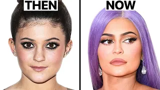 Kylie Jenner's Plastic Surgery - Surgeon Reacts