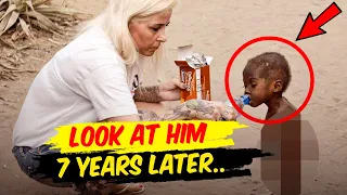 Remember The Child Whose Image Went Viral All Over The World? Here’s How His Life Turned Out