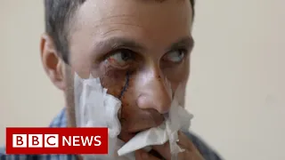 Ukrainians injured and killed by unexploded ammunition – BBC News