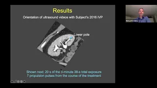 Image-Guided Ultrasound Therapy of Kidney Stones