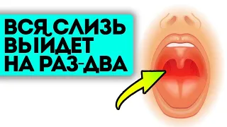 Как понять, откуда у вас слизь в горле? 7+ народных рецептов, как быстро вывести слизь из горла