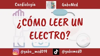 ¿Cómo Leer Un Electrocardiograma?