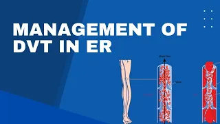 Management of DVT in ER