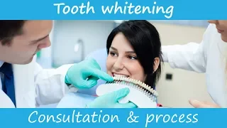 Teeth whitening at the dentist - an example consultation to start professional teeth whitening