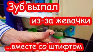 VLOG Жевачка вытащила зуб