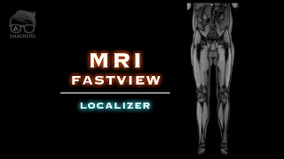 MRI – FASTVIEW LOCALIZER