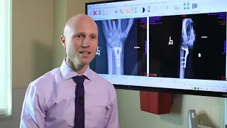 Broken Wrists: Fracture Types, Treatment Options, & Recovery - Dr. Froelich