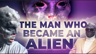Black Alien Project: $30,000 in Plastic Surgery To Become An Alien