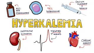 An Approach to Hyperkalemia - ECG changes in Hyperkalemia | What are the causes of Hyperkalemia?