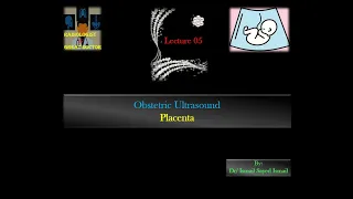 Obstetric Ultrasound -Lecture 05 -Placenta