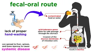 Typhoid Fever: Salmonella typhi