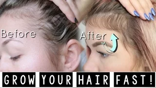 HOW I GREW MY HAIR BACK! (YOU NEED THIS!) WITH MONAT