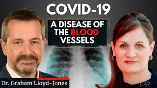 COVID-19: Lungs, Blood and Mouth Connection with Dr. Graham Lloyd-Jones