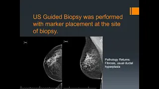 Breast imaging