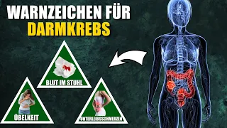 7 Warnzeichen für Darmkrebs, die du niemals ignorieren solltest