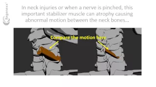 What is the multifidus function?