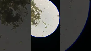 Microorganisms under a microscope