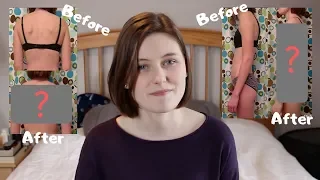 I Fixed My Posture In 30 Days (before & after transformation!)