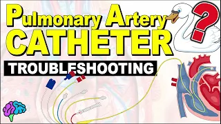 Troubleshooting Your Pulmonary Artery (PA) Catheter