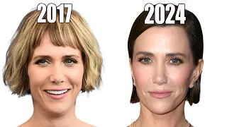 Kristen Wiig's NEW Face: This is CRAZY!!!