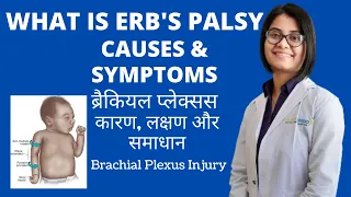 WHAT IS ERB'S PALSY, CAUSES & SYMPTOMS IN HINDI | ब्रैकियल प्लेक्सस कारण, लक्षण & समाधान  | Brachial