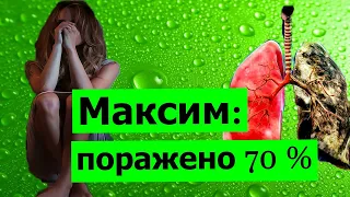 Максим: " Когда нибудь я стану ветром"(поражено 70 % легких)