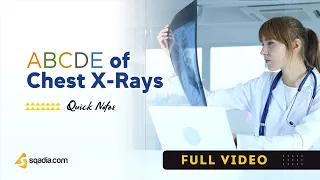 ABCDE of Chest X-Rays | How to Read and Interpret CXR | Basic Radiology | sqadia.com
