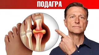 Тайна подагры раскрыта! Что вызывает подагру на самом деле? 😲