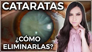 Así se eliminan las CATARATAS 👁 l Todo lo que tienes que saber 👩🏻‍⚕️@DraPauZuniga