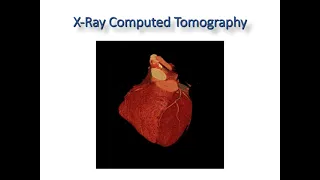 Cardiac Imaging in Stable CAD: the broader perspective