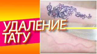 Удаление татуировки хирургическим путем. Цветное тату на руке