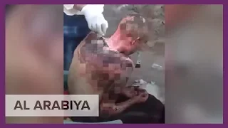 Graphic Video: This is how the Houthi’s tortured a Yemeni pharmacist by burning him