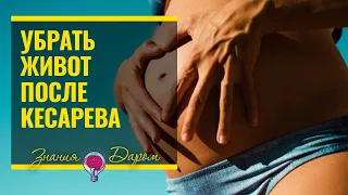 КАК УБРАТЬ ЖИВОТ ПОСЛЕ КЕСАРЕВА СЕЧЕНИЯ