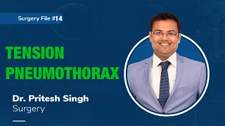 Topic | TENSION PNEUMOTHORAX I Dr. Pritesh Singh | Surgery