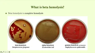 Group A Beta-Hemolytic Strep (S. pyogenes) - Microbiology Boot Camp