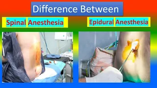 Difference between Spinal Anesthesia and Epidural Anesthesia