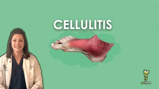 Cellulitis