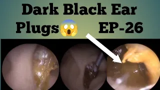 DARK BLACK LARGE EAR WAX PLUGS- EP26
