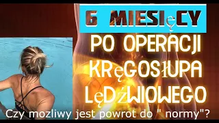 6 miesięcy po operacji kręgosłupa . Czy możliwy jest calkowity powrót do zdrowia?