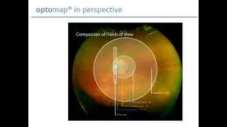 Important Findings in the Retinal Periphery: The Case for Ultra-widefield Imaging