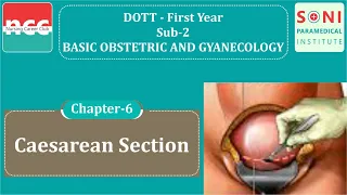 DOTT 1.2.6  Caesarean Section