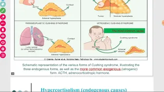 Disorders of adrenal gland