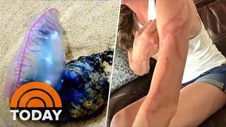 Portuguese Man O' Wars Put Spring Breakers On High Alert