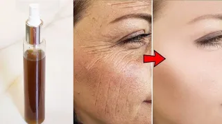 Anti ageing Clove Toner to rid of Fine lines & Wrinkles | Close Enlarged Open Pores in 7 Days
