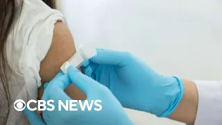 Why flu cases are on the rise again and when they will go down