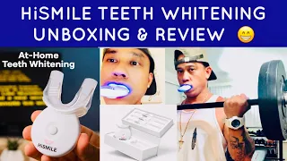 HiSMILE TEETH WHITENING UNBOXING & REVIEW | WHAT TO EXPECT